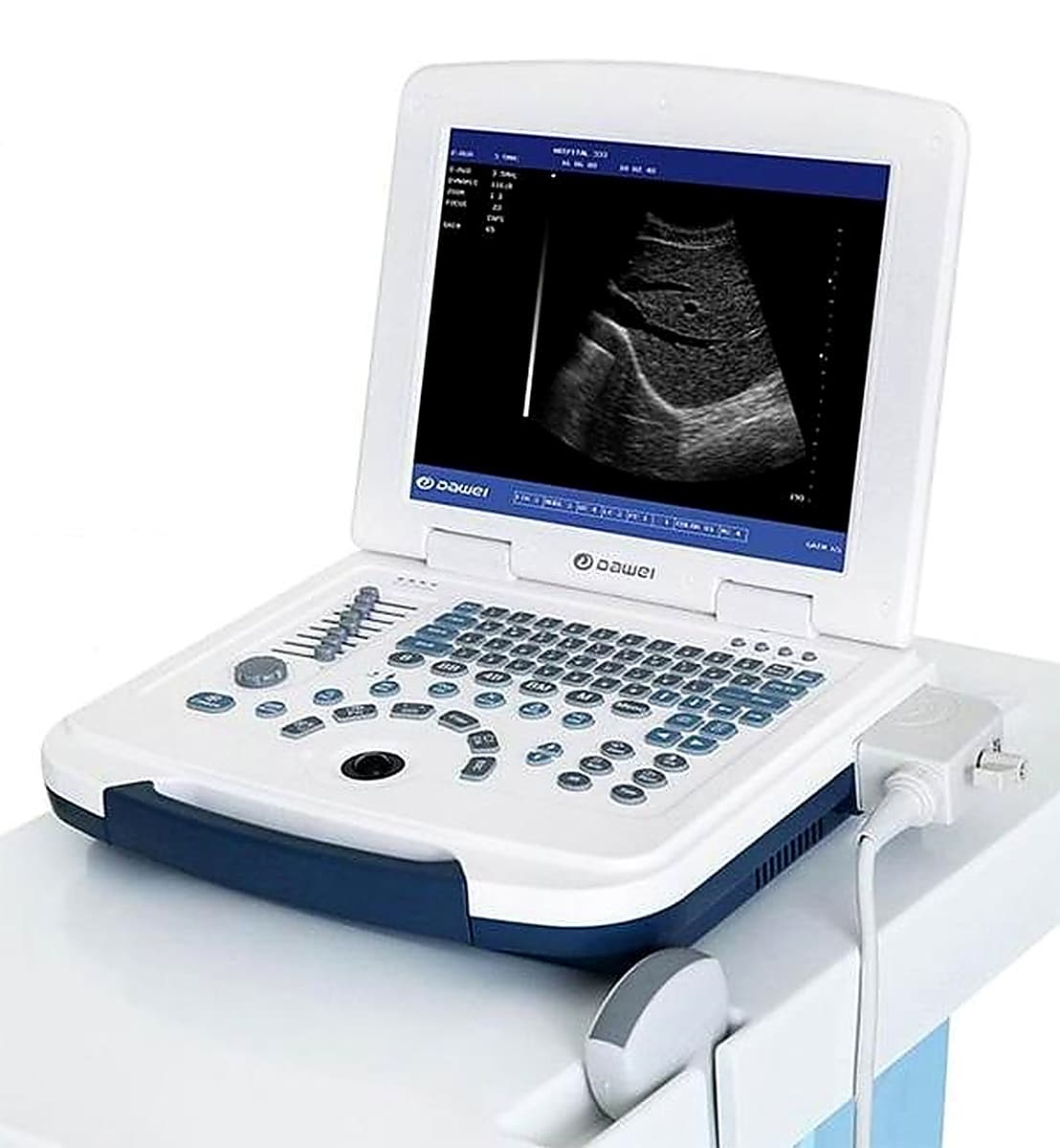 ເຄື່ອງກວດ ultrasound ສີດຳ ແລະ ສີຂາວ ແບບພົກພາ (ULTRASOUND ສີດຳ/ຂາວ)